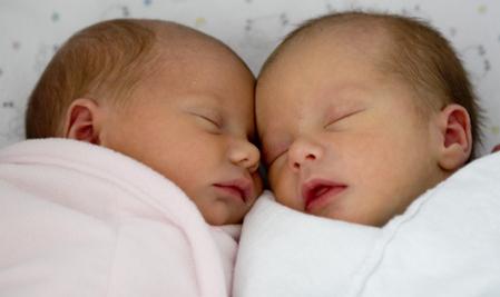जन्मजात जुड़वा कहानियां