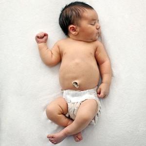 एक नवजात शिशु के नाभिकीय घाव का उपचार: इसके लिए क्या आवश्यक है और प्रक्रिया कैसी है